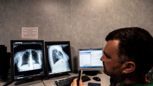 Tumore del seno, grazie a progetto oltre 1.600 mammografie per le donne fragili
