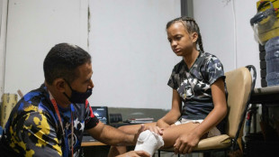 Au Venezuela, des amput&eacute;s devenus "r&eacute;parateurs" d'&ecirc;tres humains