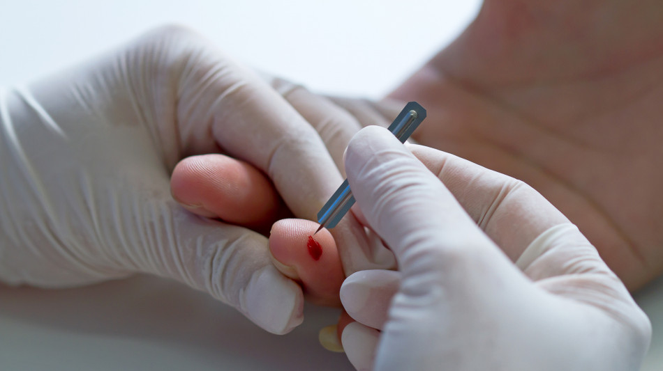 Infrarossi su una goccia di sangue per monitorare la salute