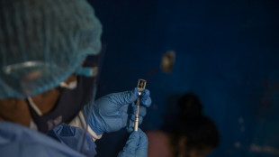 Per&uacute; registra primera muerte de una persona infectada con viruela del mono