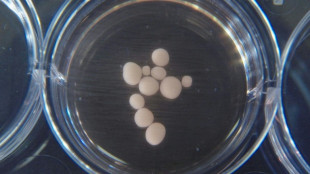 Sant&eacute;: cr&eacute;er des mini-organes pour soigner les maladies