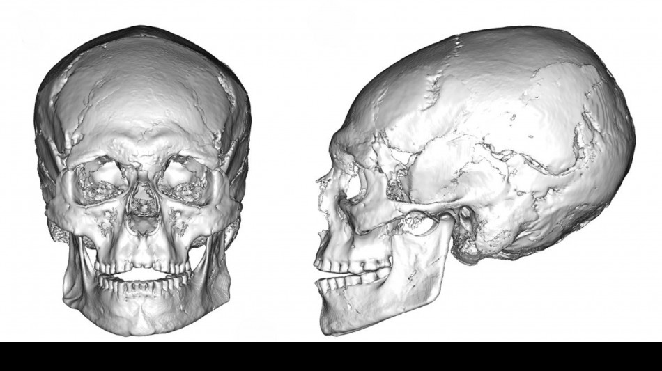 Cranio di 12.000 anni svela pratica intenzionale di deformazione