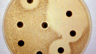 Un anticorpo 'vince' antibiotico-resistenza di un super-batterio