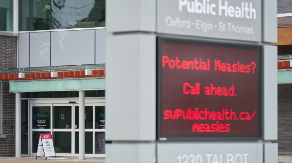 Los casos de sarampi&oacute;n en Canad&aacute; superan los 4.500, la cifra m&aacute;s alta en las Am&eacute;ricas