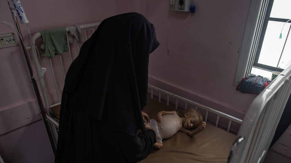 Ministero Salute Gaza, 4 morti per fame in 24 ore, anche 2 bimbi
