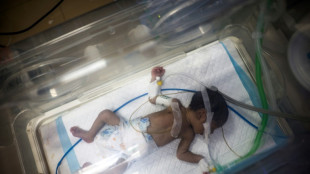 Un m&eacute;dico de Gaza sigue atendiendo a heridos pese a haber perdido una pierna en un bombardeo