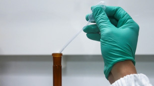 Sant&eacute;: le financement de l'innovation, un casse-t&ecirc;te &agrave; r&eacute;soudre