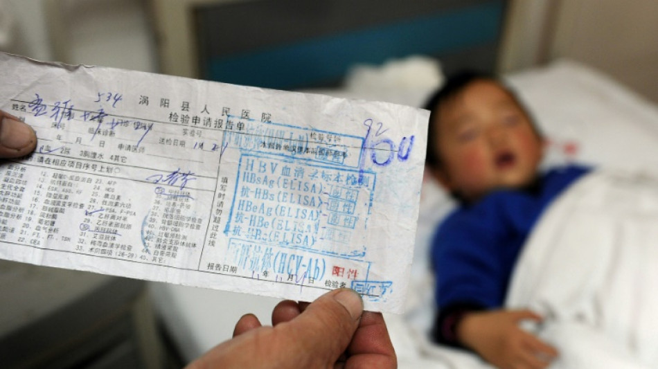 El virus de la hepatitis mata a 3.500 personas por d&iacute;a, seg&uacute;n la OMS